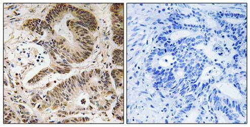 PIK3R5 Antibody