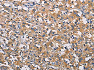 PIKFYVE Antibody