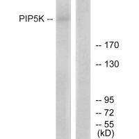PIKFYVE antibody