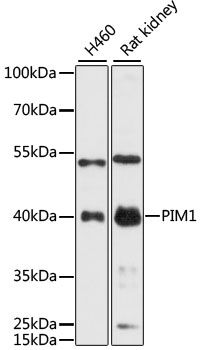 PIM1 antibody