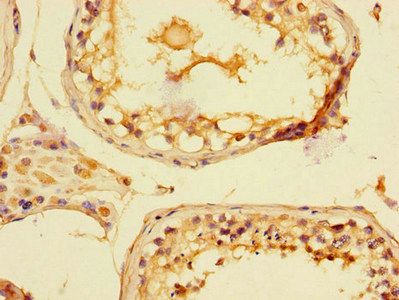 PIM2 Antibody