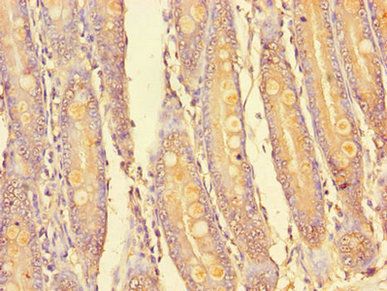 PIM2 Antibody
