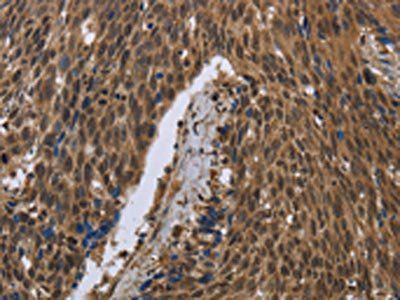 PIP Antibody