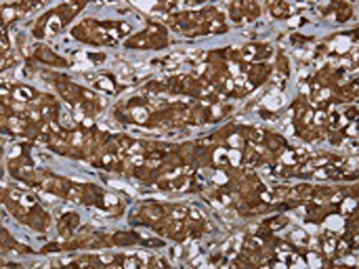 PIP Antibody