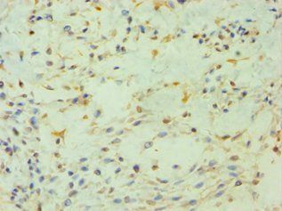 PIP4K2B Antibody