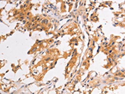 PIP5K1A Antibody