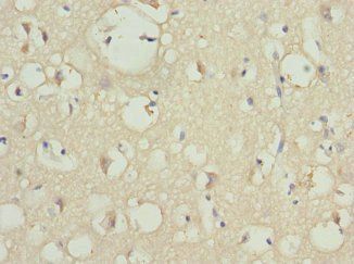 PIP5K1B Antibody
