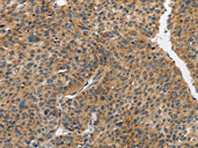 PIP5K1C antibody