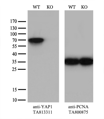 PIKFYVE Antibody