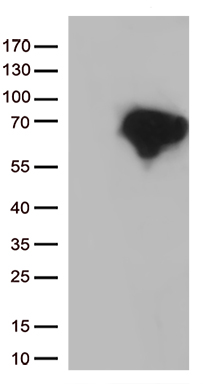 PIKFYVE Antibody
