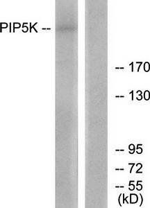 PIP5K Antibody