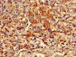PIPOX Antibody