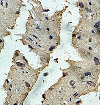 PIPOX Rabbit Polyclonal Antibody