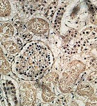PISD Rabbit Polyclonal Antibody