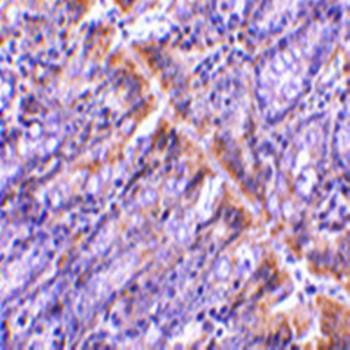 PIST Antibody