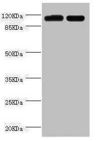 PITRM1 Antibody
