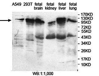 PITRM1 Rabbit Polyclonal Antibody