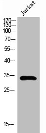 PITX1 Antibody