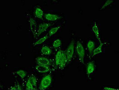 PITX2 Antibody