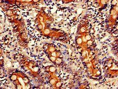 PITX2 Antibody