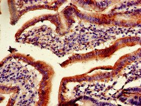 PITX2 Antibody