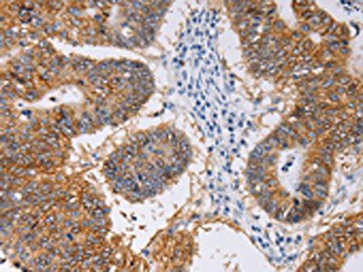 PIWIL1 Antibody