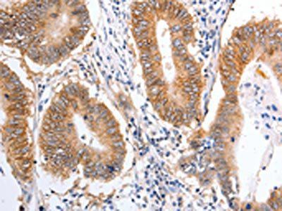 PIWIL1 Antibody