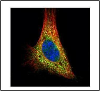 PKA C alpha Rabbit Polyclonal Antibody