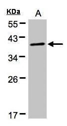 PKA C alpha Rabbit Polyclonal Antibody