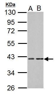 PKA C alpha Rabbit Polyclonal Antibody