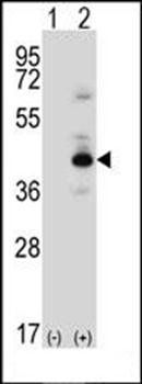 PKA C-beta antibody
