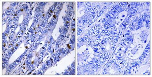 PKA-R2β (Ab-113) Antibody