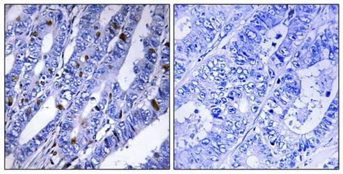 PKA-R2beta antibody