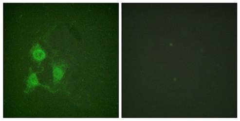 PKA alpha/beta CAT (phospho-Thr197) antibody