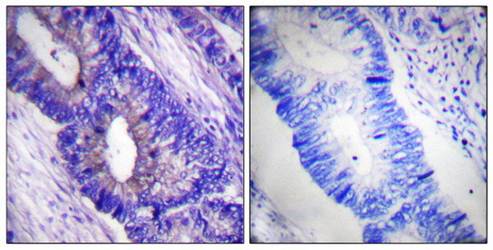 PKA alpha/beta CAT (phospho-Thr197) antibody