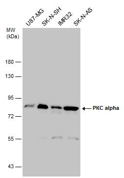 PKC alpha antibody