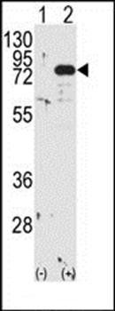 PKC beta1/2 antibody