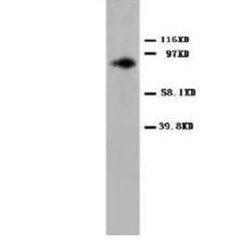 Anti-PKC alpha/PRKCA Antibody