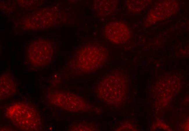 PKCβ (Phospho-Thr641) Antibody