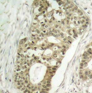 PKCδ (Phospho-Ser645) Antibody