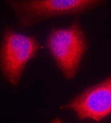 PKCθ (Ab-676) Antibody