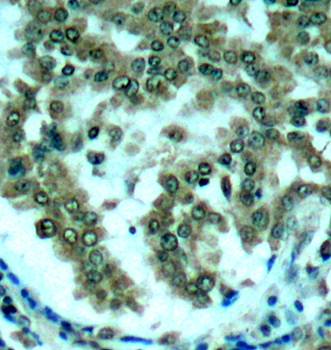 PKCθ (Ab-676) Antibody