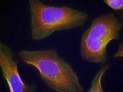 PKCθ (Phospho-Ser676) Antibody