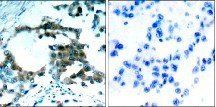PKCθ (Phospho-Ser695) Antibody