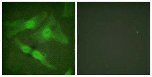 PKC ζ (Phospho-Thr410) Antibody