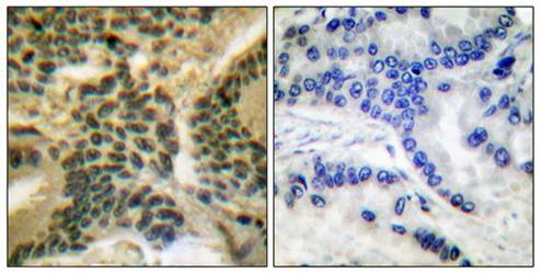 PKC ζ (Phospho-Thr410) Antibody