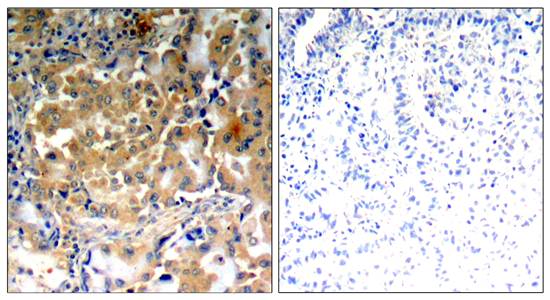 PKCζ(Phospho-Thr410) Antibody