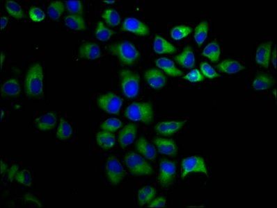 PKD1 antibody