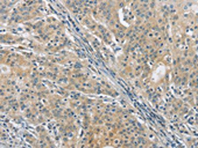 PKD1 antibody