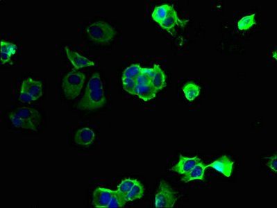 PKD1L2 Antibody